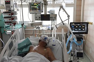 Pacient s koronavirem leží 5. října 2020 na jednotce intenzivní péče Kliniky infekčních, parazitárních a tropických nemocí v pražské Nemocnici Na Bulovce.