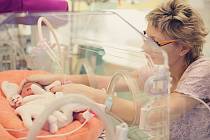 Předčasně narozené děti mnohdy stráví první měsíce v inkubátoru. Jejich stav je potřeba hlídat i proto, že kvůli nedostatku železa bývají anemické.