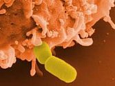 Bakterie listerie zvětšená mikroskopem.