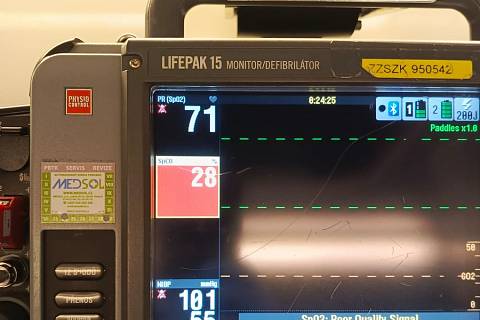 Kroměřížští zdravotničtí záchranáři ošetřovali v pondělí 18. března 2024 ženu a dítě přiotrávené nebezpečným oxidem uhelnatým.