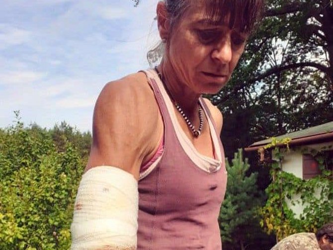 Běžkyni a výzkumnici Alenu Žákovskou na Sportovním ostrově Ludvíka Daňka v Blansku napadl pes.
