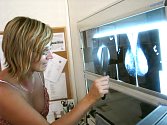 Břeclavská poliklinika se může pochlubit novým moderním způsobem snímání rentgenového obrazu.