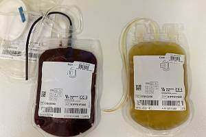 Krevní plazma se podává pacientům s velkým krvácením