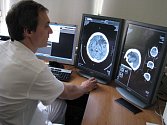 Znojemská nemocnice má nový digitální rentgen