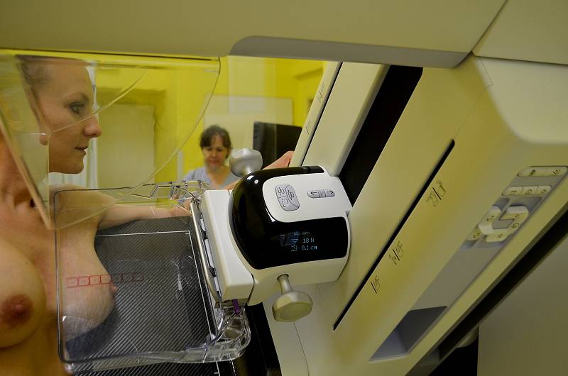 Krnovská nemocnice představila nový mamograf. Jedná se o investici za téměř pět milionů korun. Foto: Jiří Krušina