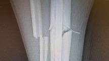 Takhle dopadla pravá noha Kamila Podolského po střetu s brankářem Litoměřicka.